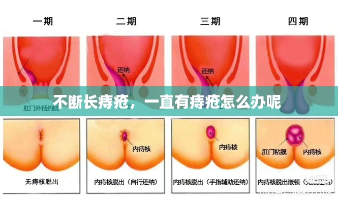 不斷長痔瘡，一直有痔瘡怎么辦呢 