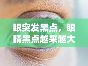 眼突發(fā)黑點(diǎn)，眼睛黑點(diǎn)越來越大 