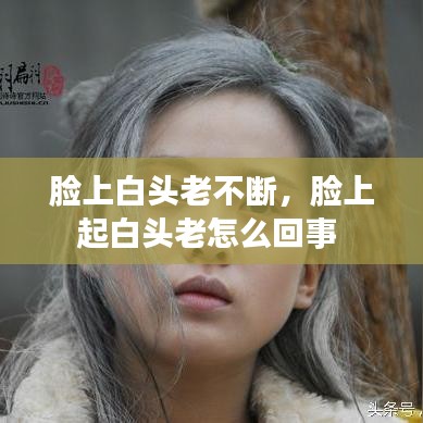 臉上白頭老不斷，臉上起白頭老怎么回事 